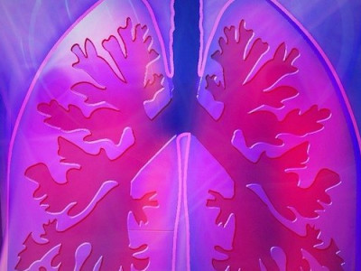 Polosa’s COPD Follow-up Image